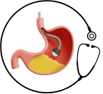 Dr Prashant Verma, Bariatric, Gastro, Cancer & General Surgeon